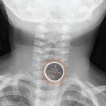 504_Button Batteries_Poster_D03_A3