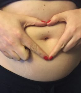 My perfect "mommy tummy" is soft, squishy, and streaked with stretch marks.